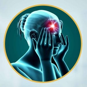 الصداع النصفي