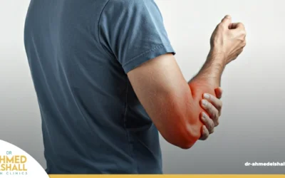 علاج آلام الذراع